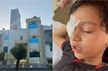 7-year-old goes for surgery, Greater Noida doctor operates on wrong eye